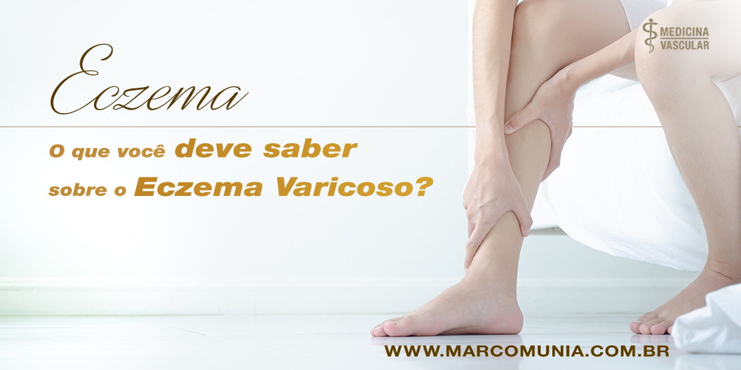 Eczema | O que você deve saber?